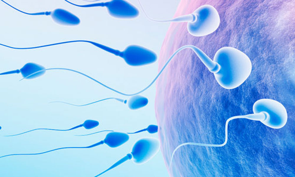 Intracytoplasmic Sperm Injection
