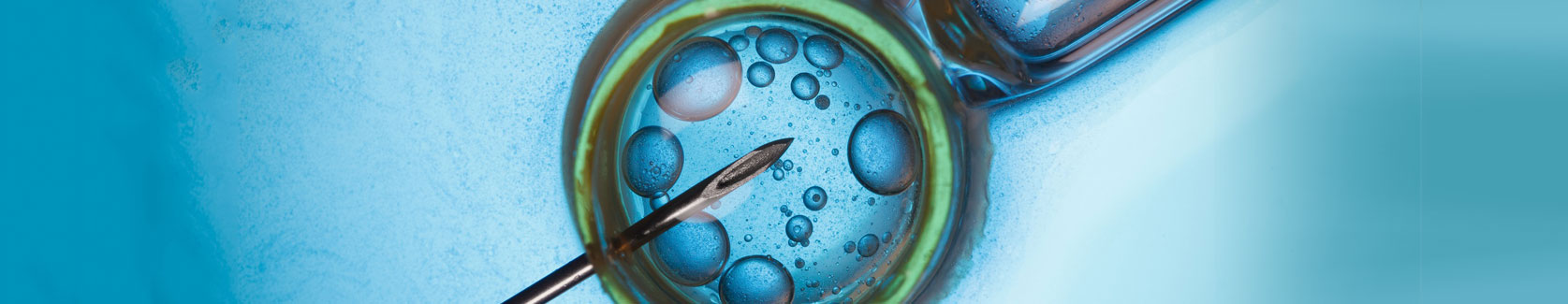 Semen Analysis