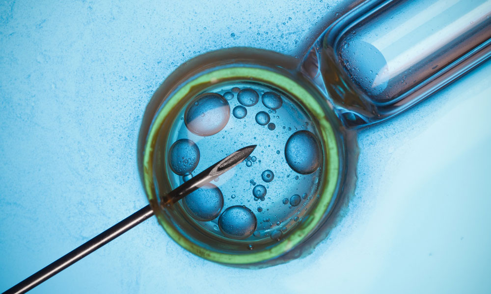 Semen Analysis